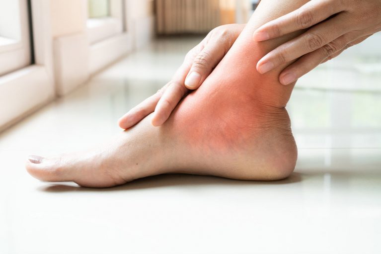 Dolore o malformazioni del piede - Centro medico SME